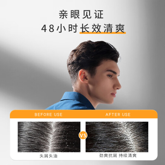 去屑洗發(fā)水